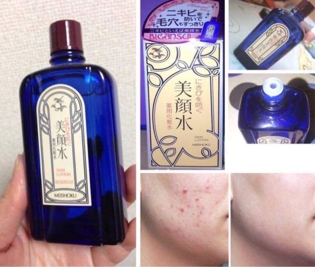 ðĨMeishoku Bigansui Japan Century Acne LotionâĻāļāđāļāļāļāļąāļāđāļĨāļ°āļĢāļąāļāļĐāļēāļŠāļīāļ§āđāļāļŦāļāļķāđāļāđāļāļĩāļĒāļ§ āļŠāļģāļŦāļĢāļąāļāļāļđāđāļĄāļĩāļāļąāļāļŦāļēāļŦāļāđāļēāļĄāļąāļ āļŠāļīāļ§āļāļāļāļ·āđāļ āļŠāļīāļ§āļāļąāļāđāļŠāļðĨāļĒāļāļāļāļēāļĒāļāļąāļāļāļąāļ 1ðāđāļāļāļĩāđāļāļļāđāļ āļāļāļēāļ 90 ml.