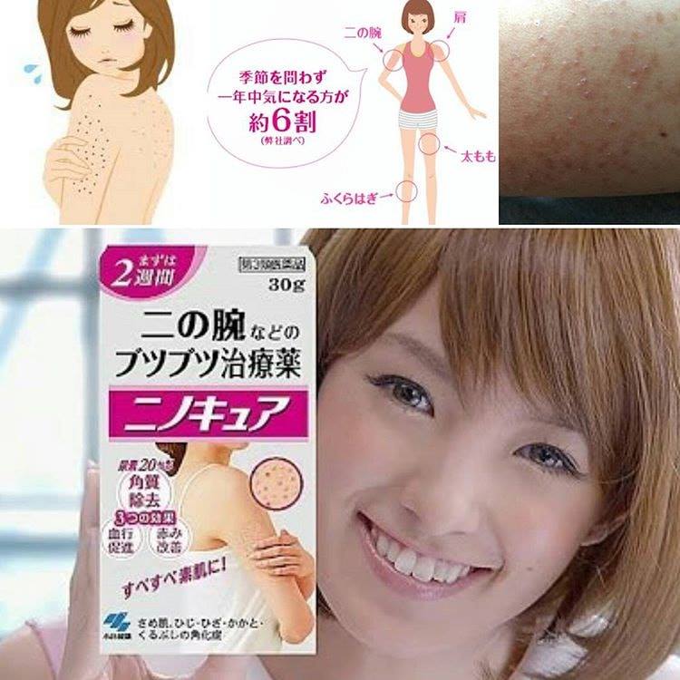 ðĨāļāļĢāļĩāļĄāļāļēāļāļāļāļļāļ Kobayashi Ninokyu NinocureâĻāļŠāļģāļŦāļĢāļąāļāļāļēāļāļļāđāļĄāļŦāļāļąāļāđāļāđ āļāļāļāļļāļ āļĢāļāļĒāđāļāļĨāđāļāđāļ āļĢāļđāļāļļāļĄāļāļāļāļļāļāļāļąāļ āļāļīāļ§āđāļĄāđāđāļĢāļĩāļĒāļāđāļāļĩāļĒāļðĨāļāļāļēāļ 30g.