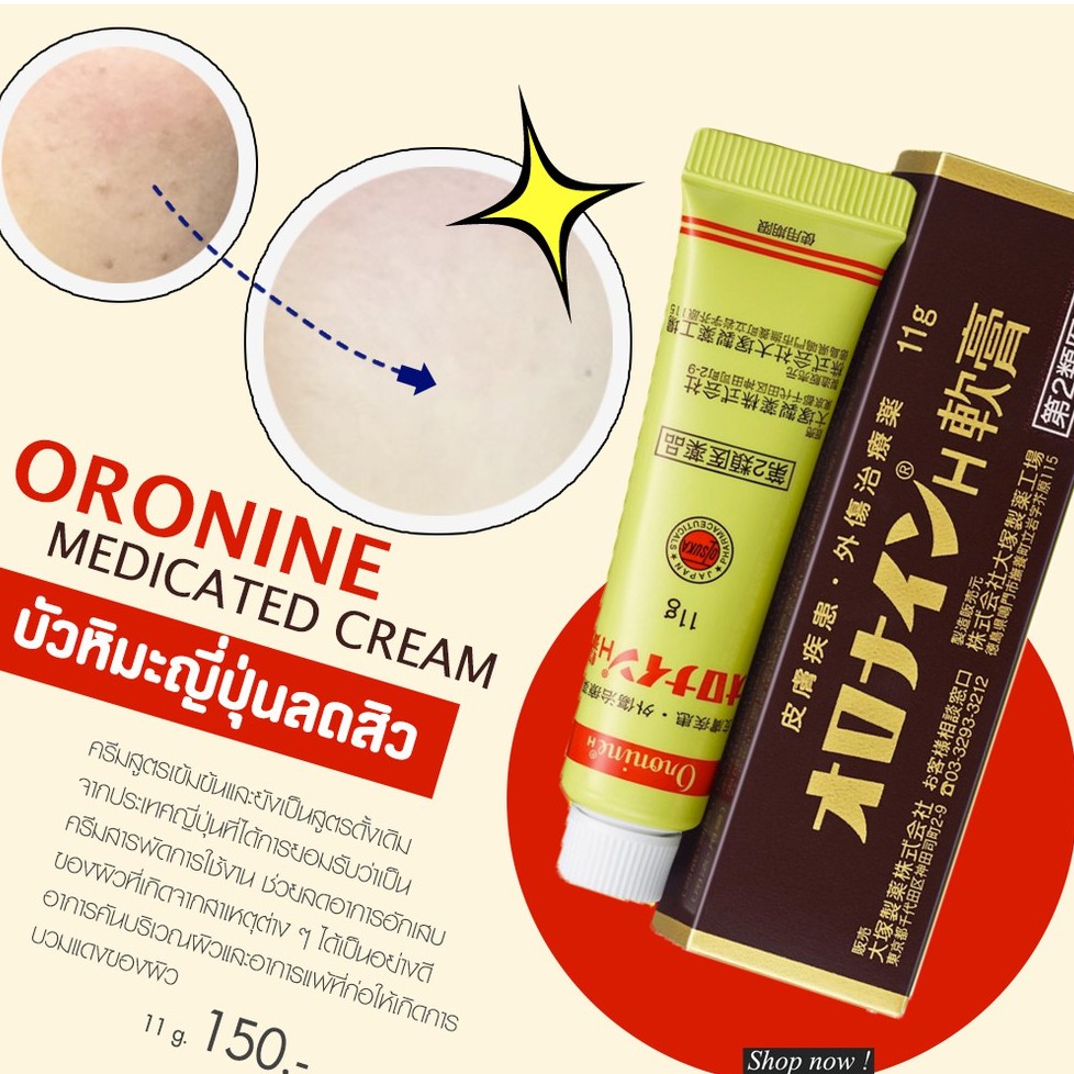 ðĨ(Hot Item)ðĨ āļāļĢāļĩāļĄāļāļąāļ§āļŦāļīāļĄāļ°āļāļĩāđāļāļļāđāļ(āđāļāļāļŦāļĨāļāļ) | Oronine H OintmentðĨāļāļāļēāļ 11 g.
