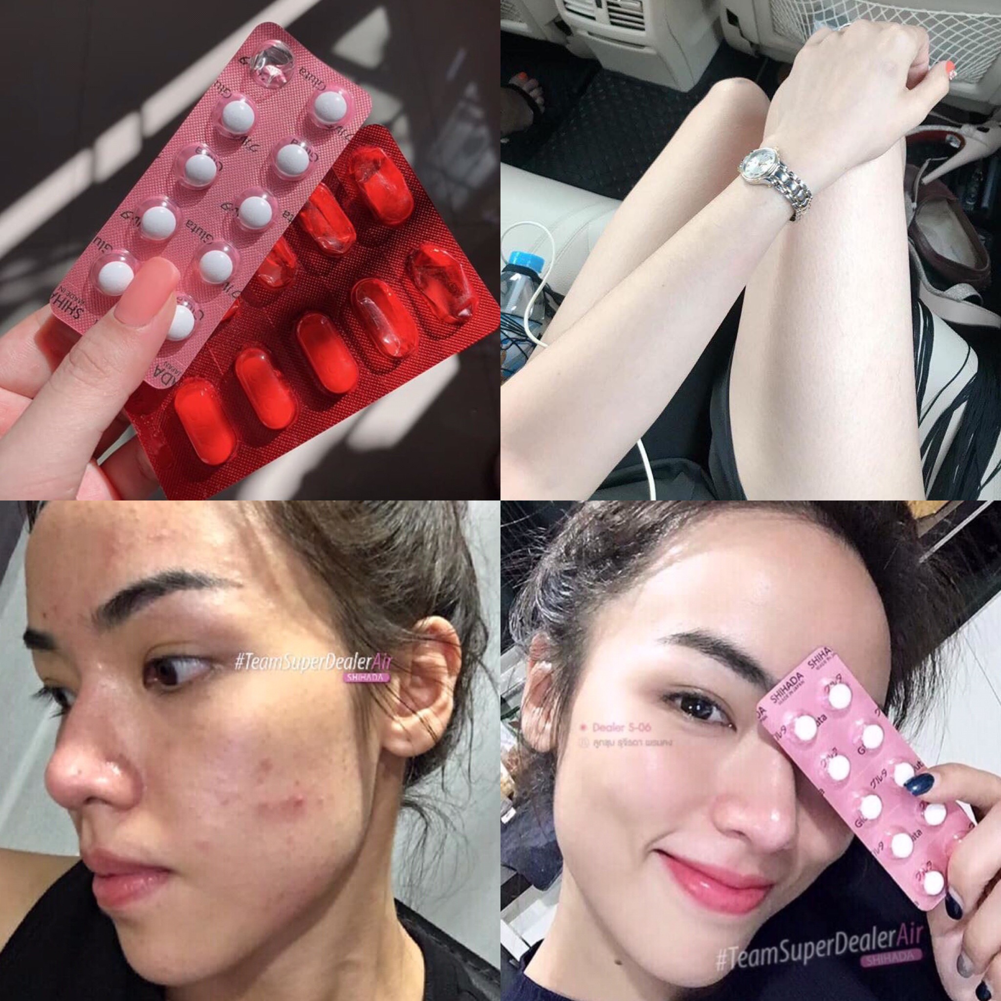 Set คู่ สุดคุ้ม vาวใส X 2 Shihada Gluta 20 เม็ด + Vitamin C Korea 20 เม็ด