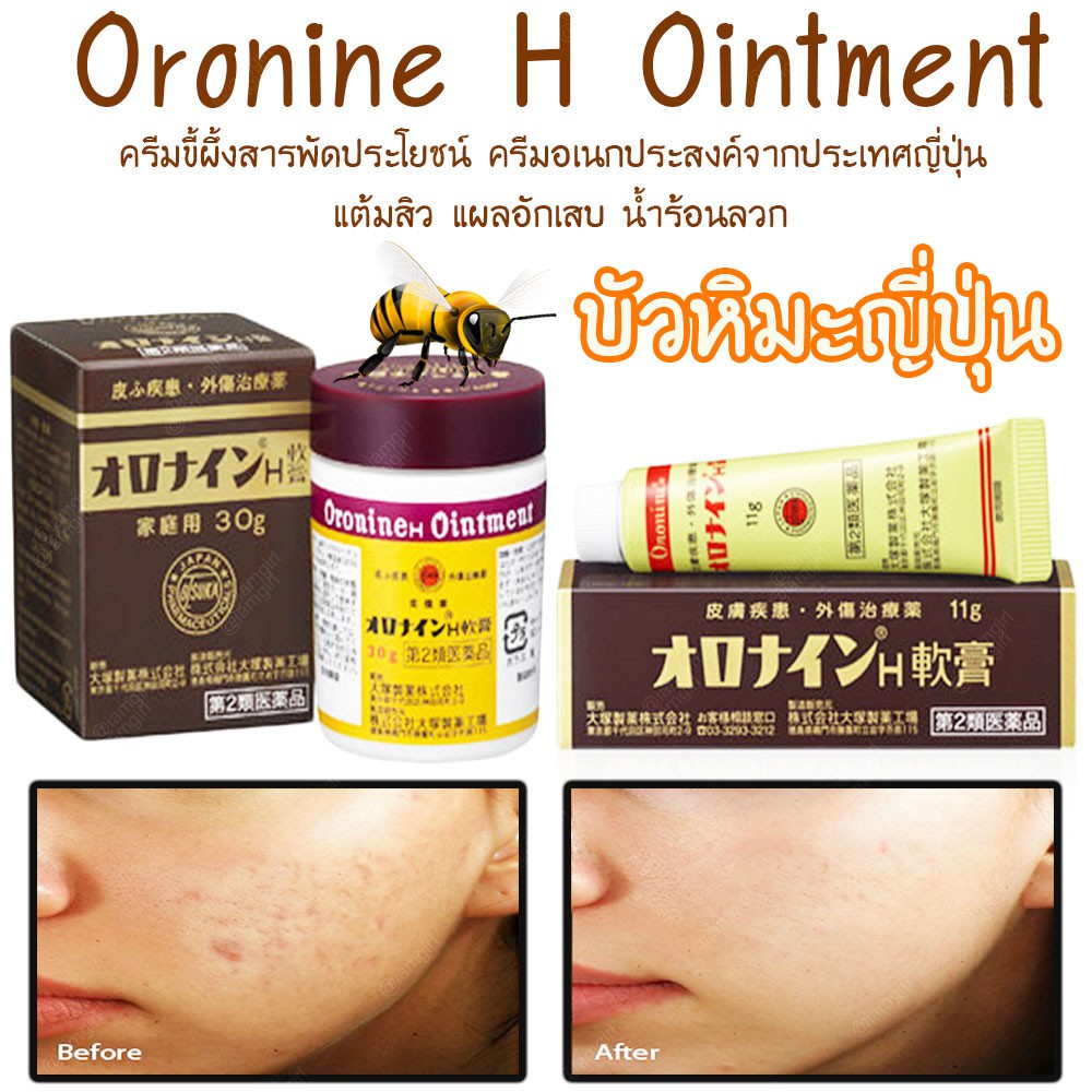 ðĨ(New)ðĨāļāļąāļ§āļŦāļīāļĄāļ°āļāļĩāđāļāļļāđāļ(āđāļāļāļāļĢāļ°āļāļļāļ) | Oronine H Ointment āļāļĢāļĩāļĄāđāļāļāļāļāļĢāļ°āļŠāļāļāđāļāļēāļāļāļĩāđāļāļļāđāļ