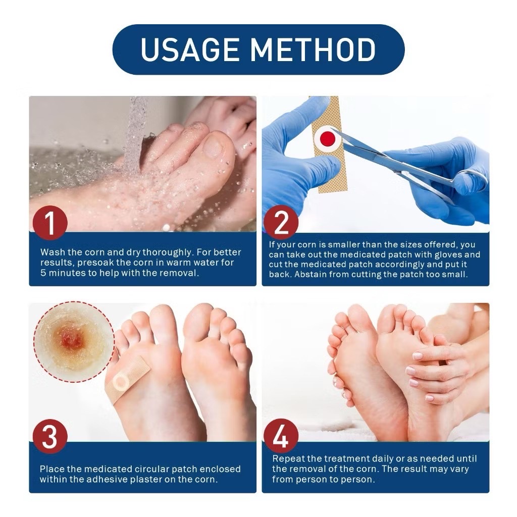 แผ่นแปะตาปลาญี่ปุ่น ใช้รักษาตาปลาและหูด พร้อมตัวยากรดซาลิไซลิก ช่วยให้ผิวหนังส่วนที่แข็งๆ อ่อนตัวนุ่มลง✨ บรรจุ 12 ชิ้น