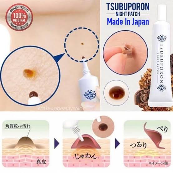 Tsubuporon Night Patch 20g. ครีมแต้มขจัดติ่งเนื้อ ตัวยาจากสมุนไพรถึง 46 ชนิดปลอดภัย ไม่แสบ