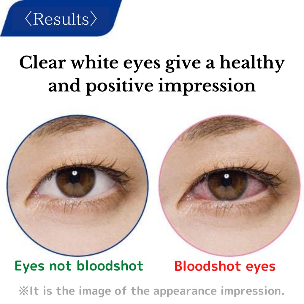 LION Smile Whiteye น้ำตาเทียมสูตรพิเศษ ที่เปลี่ยนดวงตาให้ดูขาวสดใส ดวงตาดูสุขภาพดี✨เย็นระดับ 3